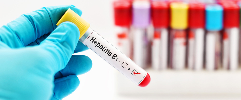 Apa itu Hepatitis B? Apa saja gejala dan cara pengobatannya?